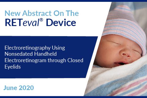 2007_electroretinography-using-nonsedated-handheld-electroretinogram-through-closed-eyelids_abstract