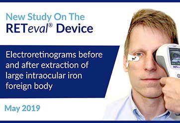 Electroretinograms-before-and-after-extraction-of-large-intraocular-iron-foreign-body