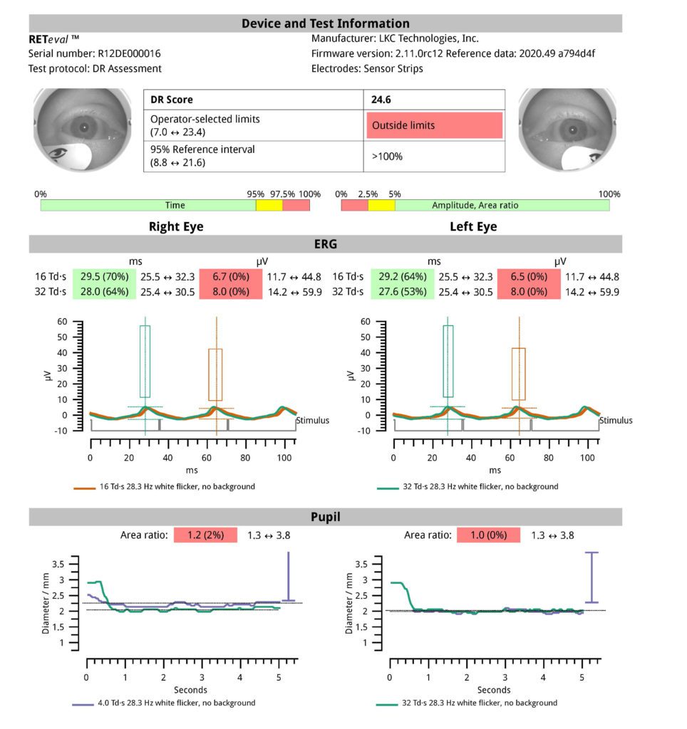 Learn more about the RETeval device