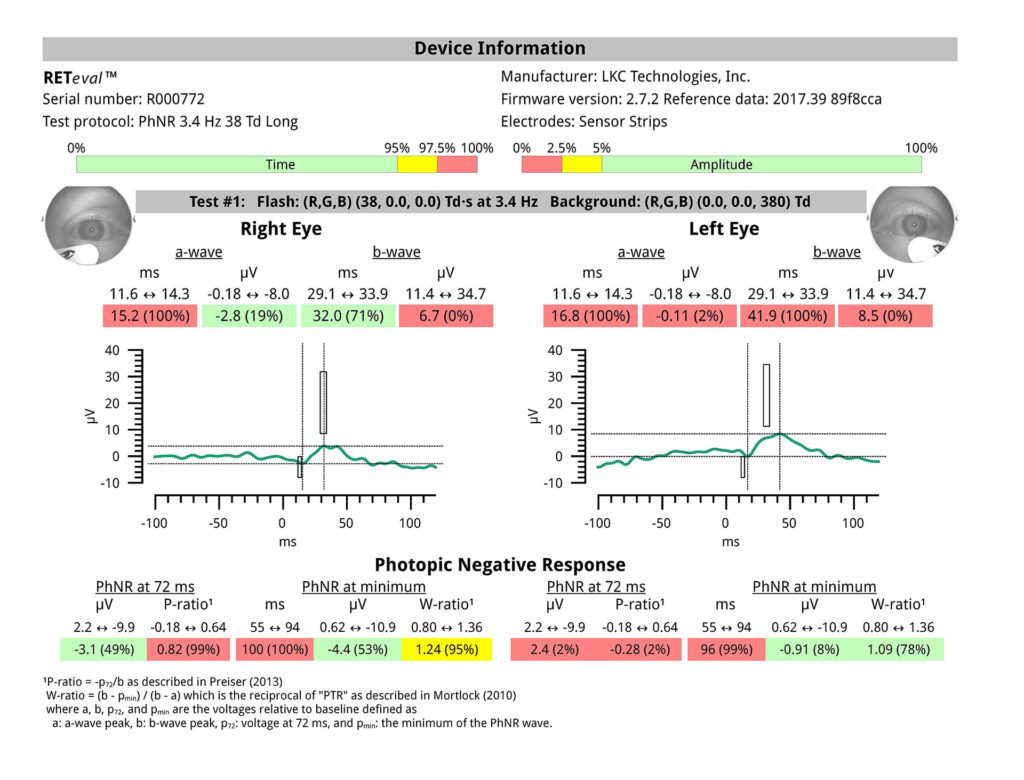 Learn more about the RETeval device