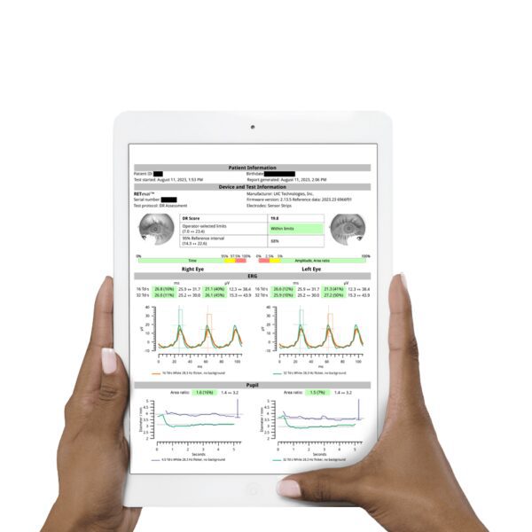 RETeval ERG Reports 4