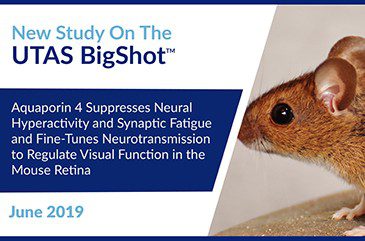Web - Aquaporin 4 Suppresses_