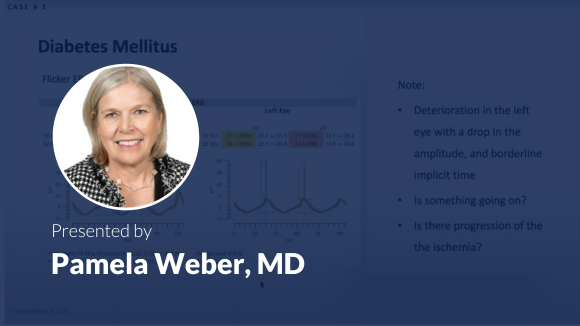 Predicting Vision Loss in a Busy Retina Practice